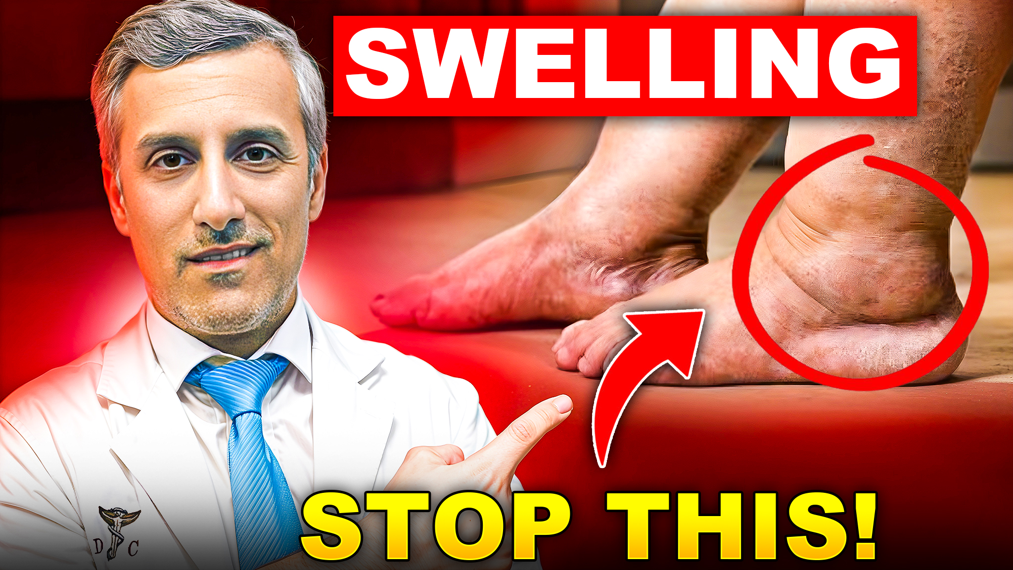 Doctor warns about foot swelling and how to stop it.
